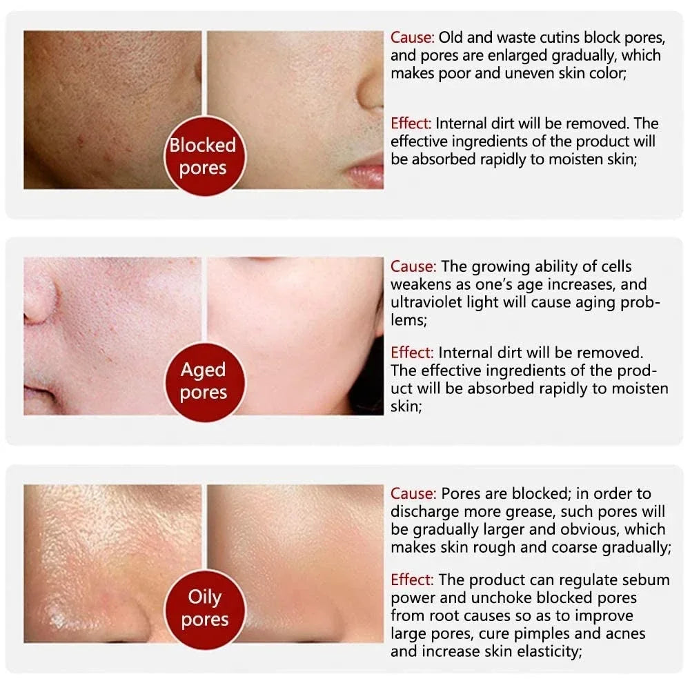 Retinol Niacinamide Serum
