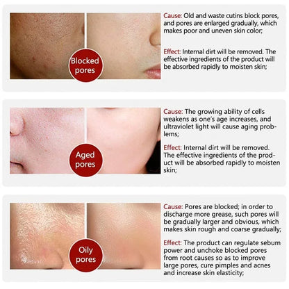 Retinol Niacinamide Serum