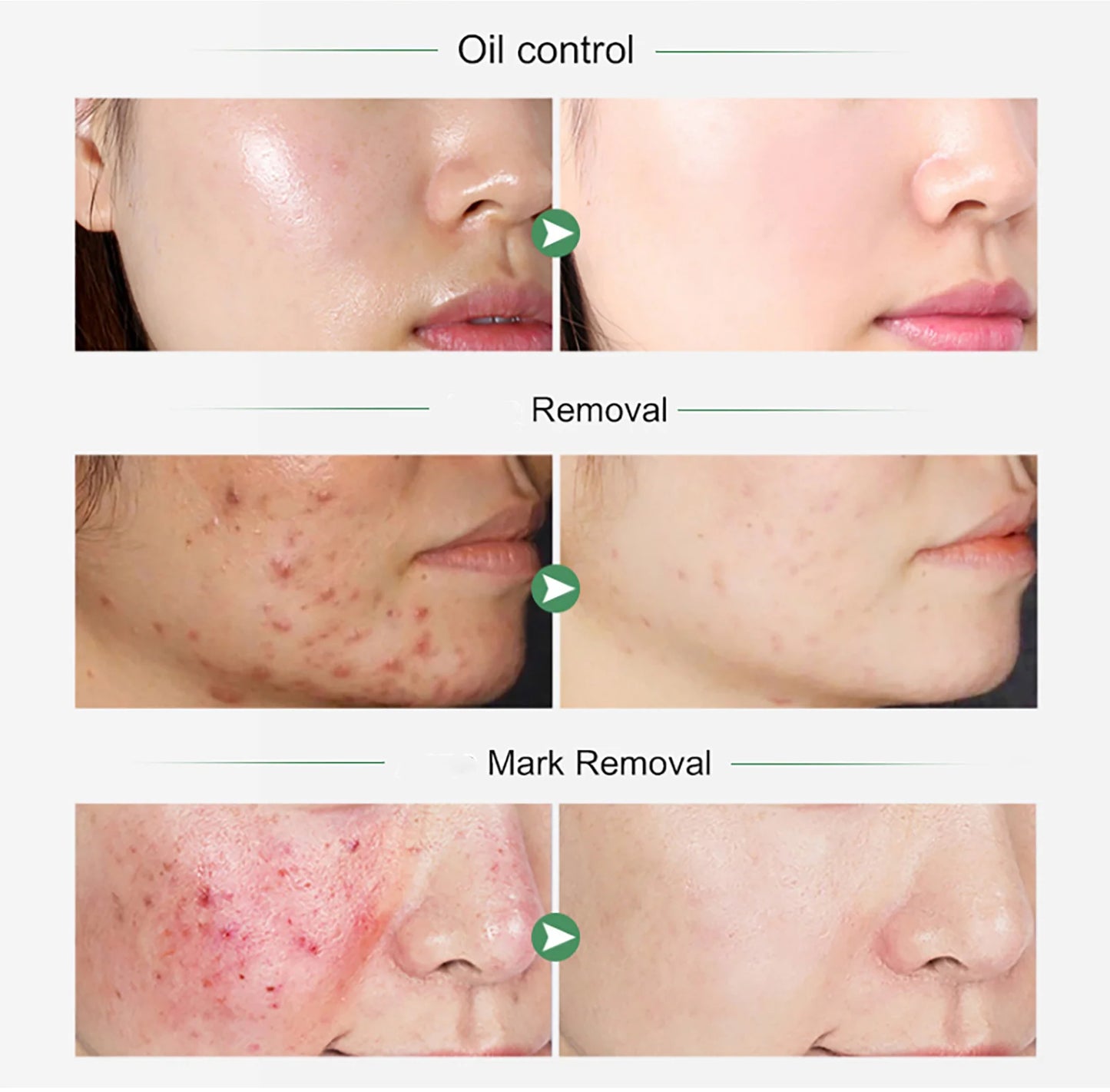 Turmeric Whitening Skincare Set
