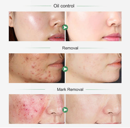 Turmeric Whitening Skincare Set