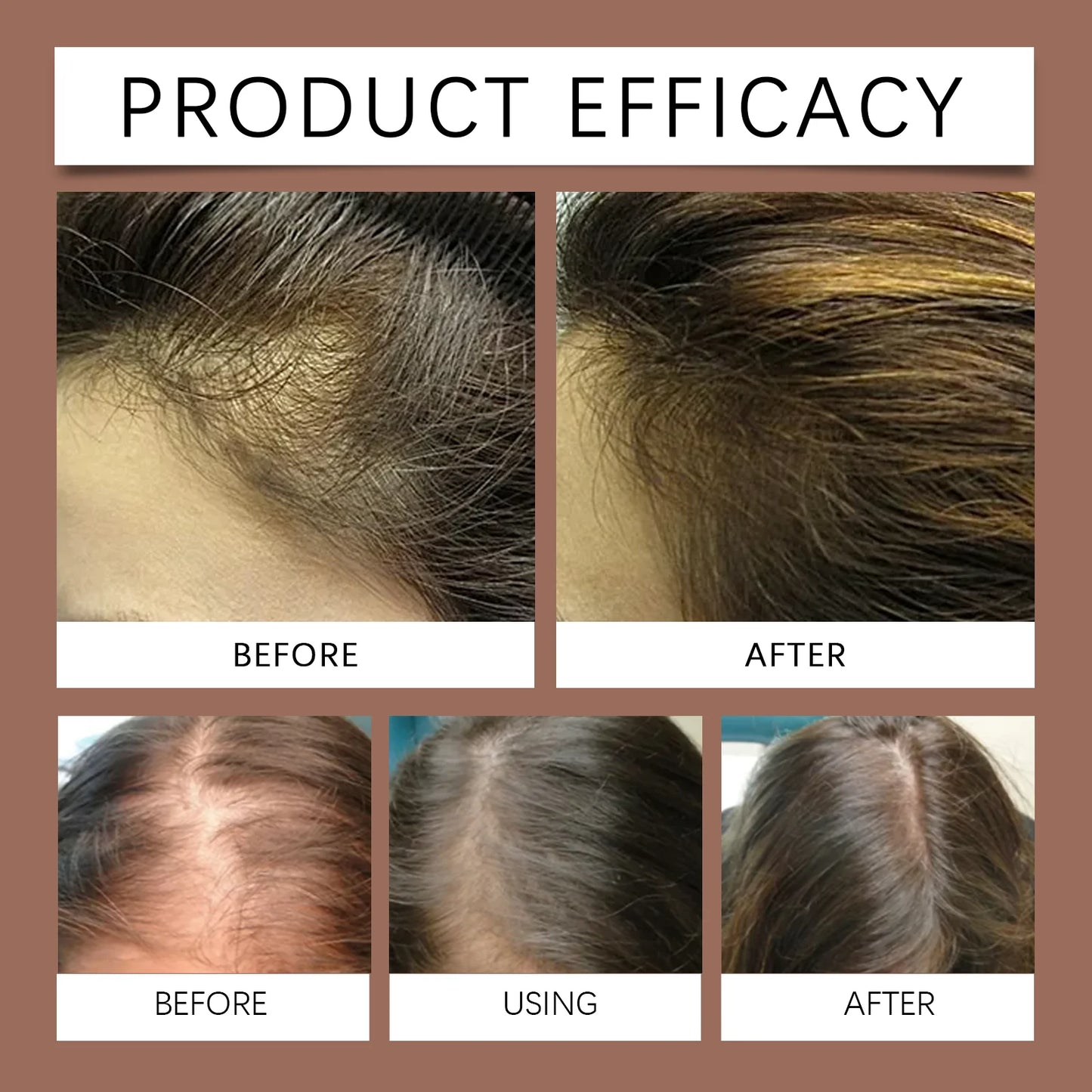 Biotin Caffeine Hair Serum Spray
