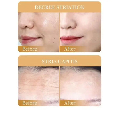 Collagen Face Masks – 10Pcs Hydrating Set