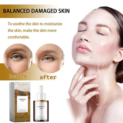 Centella Asiatica Serum Hydration & Skin Repair