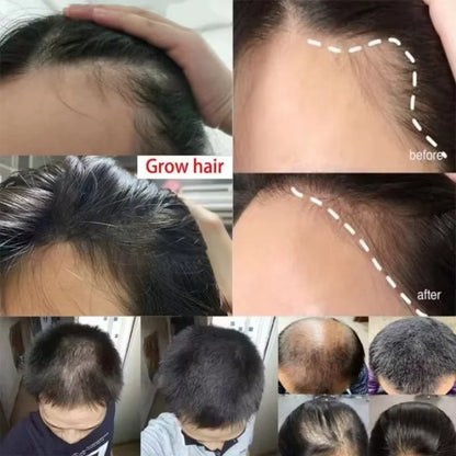 Fast Ginger Hair Growth Spray
