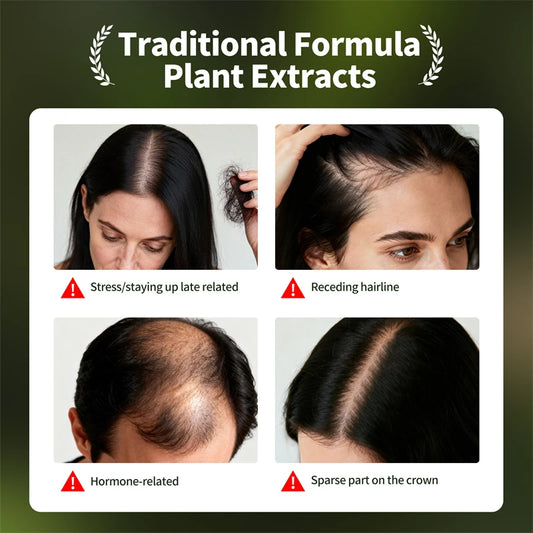 Hair Loss Prevention Set – Hair Care Kit