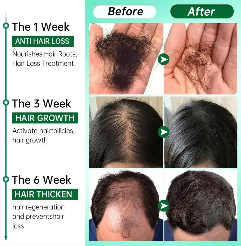 7-Day Hair Growth Serum Capsules