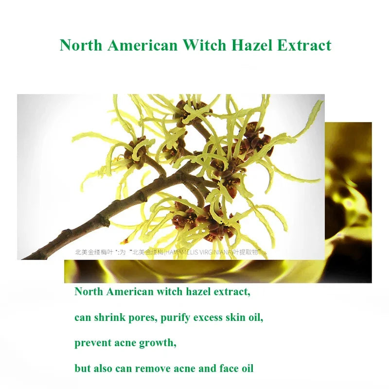 Herbal Acne Cream