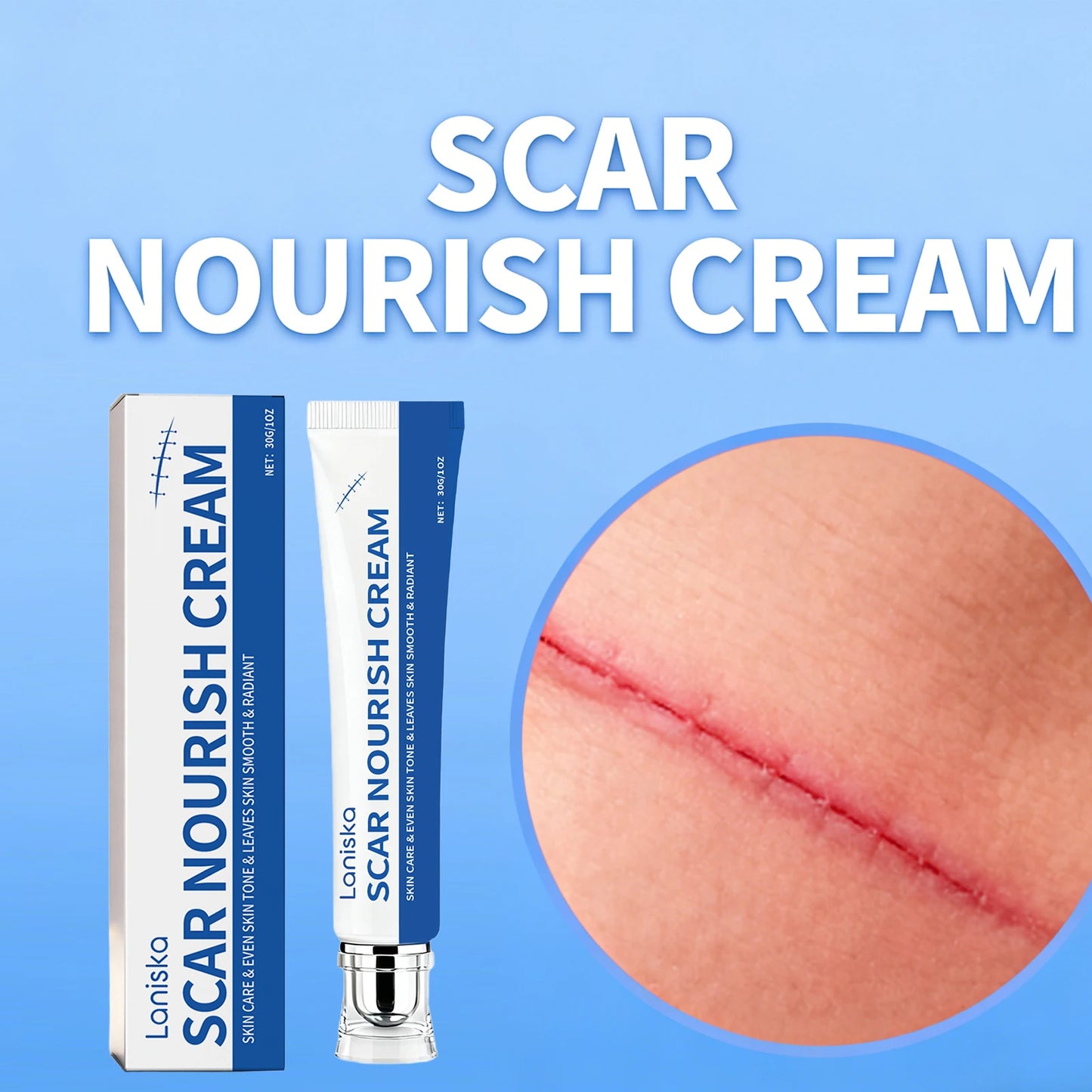 Scar Fade Cream – Even Skin Tone & Repair