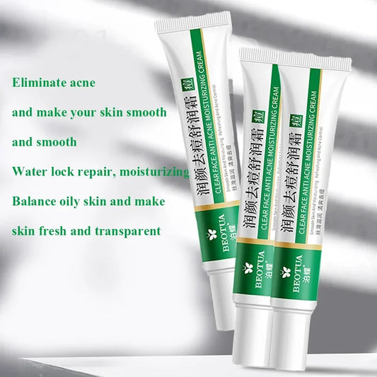 Herbal Acne Cream