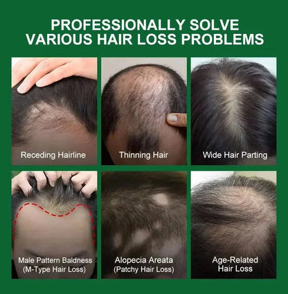 7-Day Hair Growth Serum Capsules