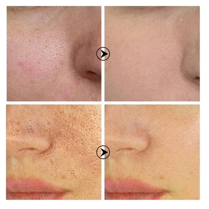 Retinol Niacinamide Serum