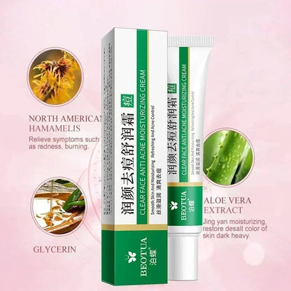 Herbal Acne Cream