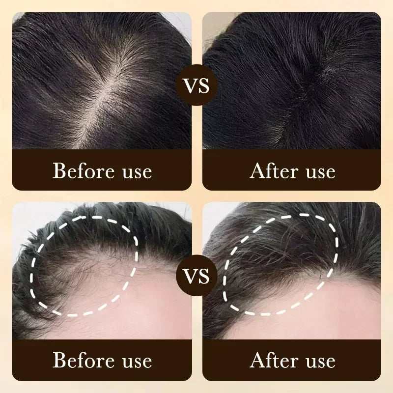 Biotin Hair Growth Oil Serum