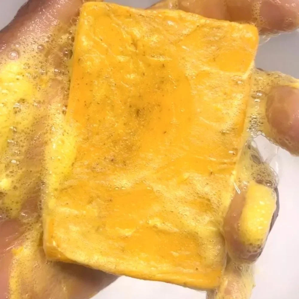 Turmeric Kojic Acid Soap – 100g, Deep Cleansing Face & Body Bar
