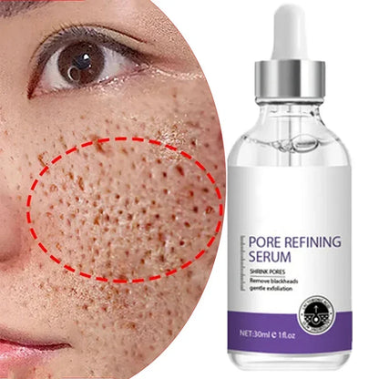 Retinol Niacinamide Serum