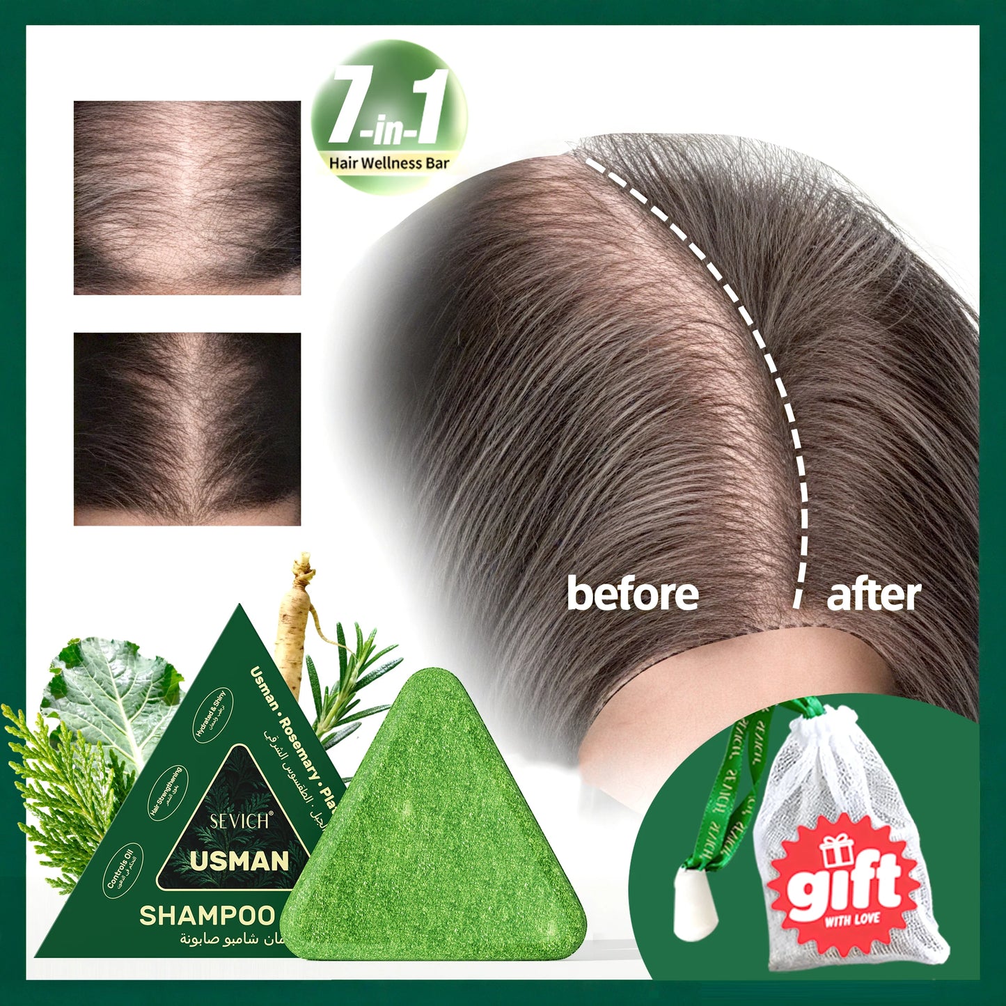 Hair Loss Prevention Set – Hair Care Kit