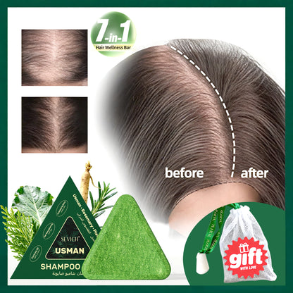 Hair Loss Prevention Set – Hair Care Kit