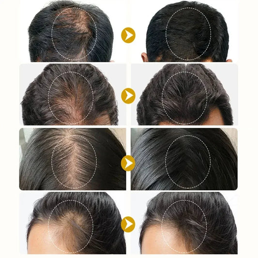 Fast Ginger Hair Growth Spray