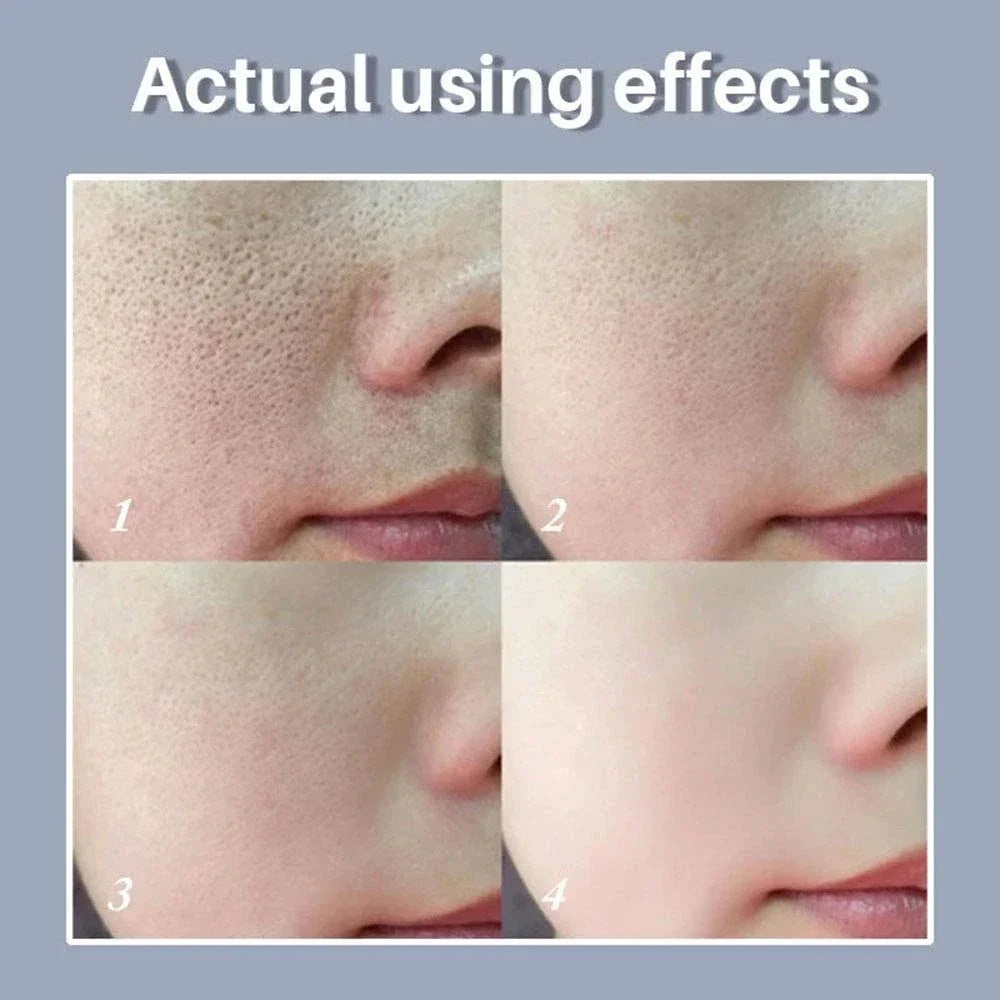 Retinol Niacinamide Serum