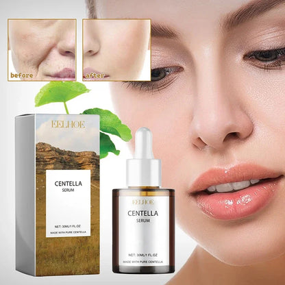 Centella Asiatica Serum Hydration & Skin Repair