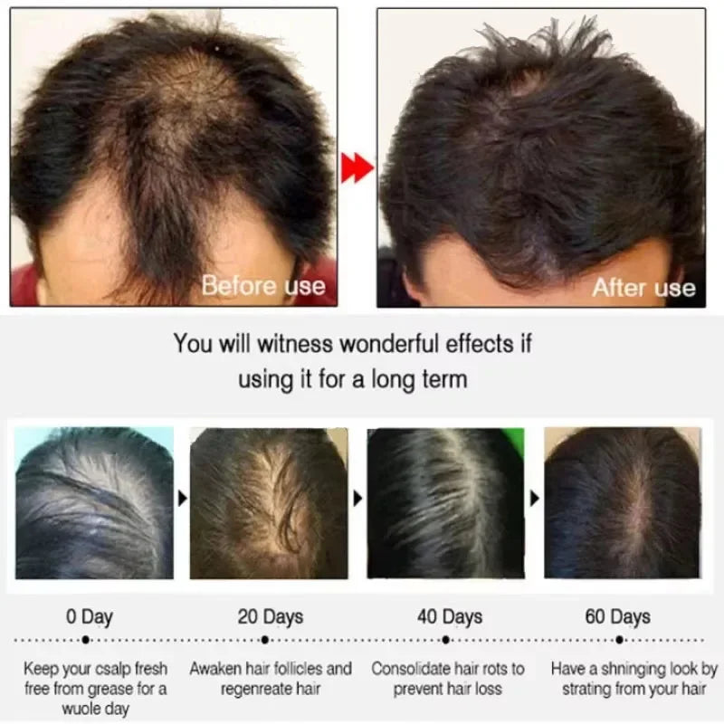 7-Day Hair Growth Serum Capsules