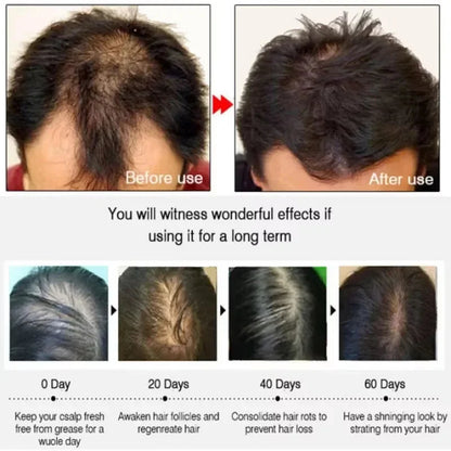7-Day Hair Growth Serum Capsules